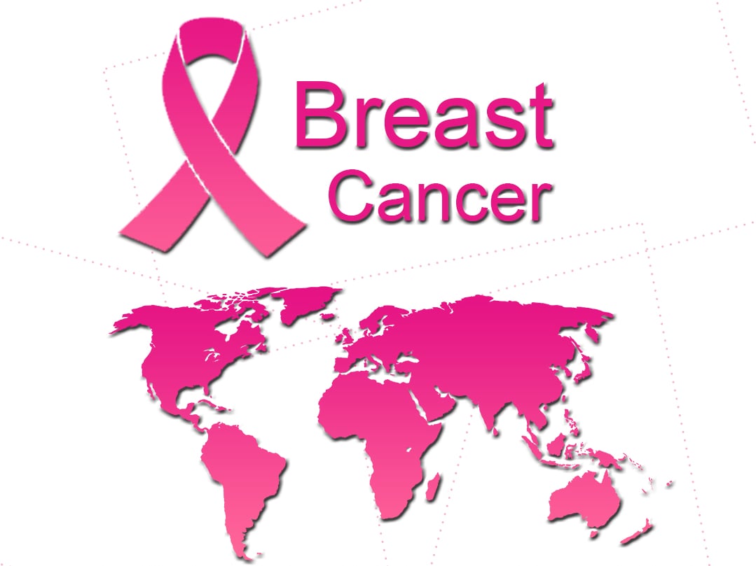 Breast Cancer