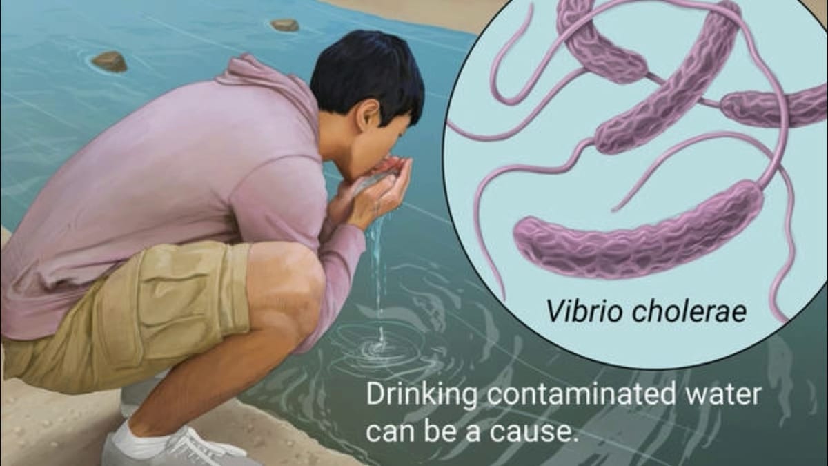 Beware of Cholera outbreak in Karen and the rest of Nairobi